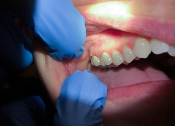 Best Teeth Whitening  in Emporia, KS
